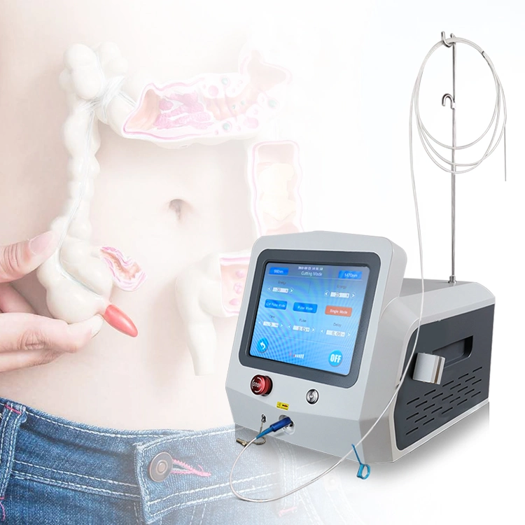 Laser Treatment for Hemorrhoids Diode Laser 980+1470nm Proctology Haemorrhoids Cutting Hemorrhoids Treatment Device