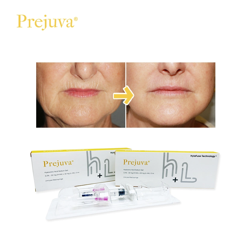 Prejuva trata de líneas finas arrugas Acide Hyaluronique Profhilo H+L 1 X 2ml Profhilo Booster para inyección de Cuerpo de piel