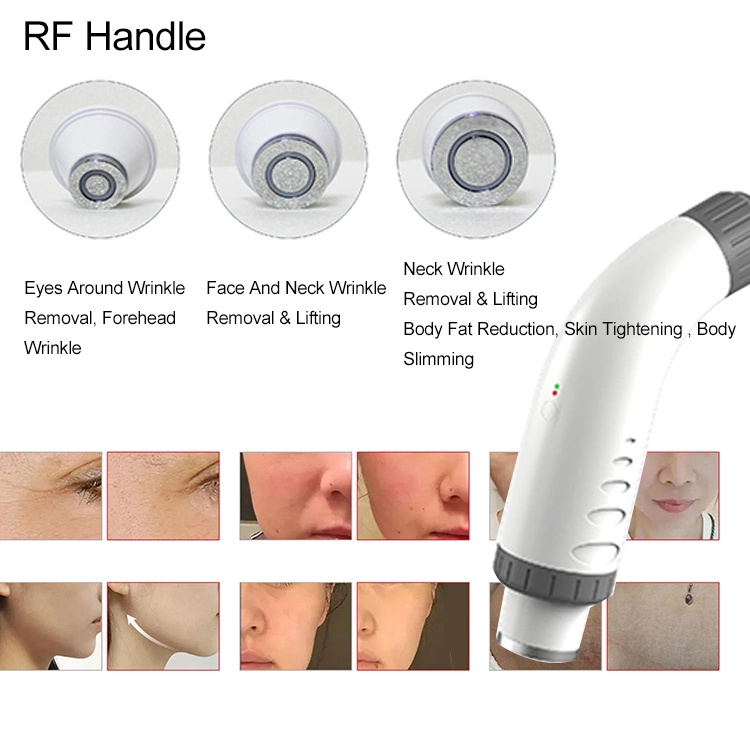 Épilation à lumière pulsée tous les types de peau épilation indolore Rajeunissement de la peau avec la machine