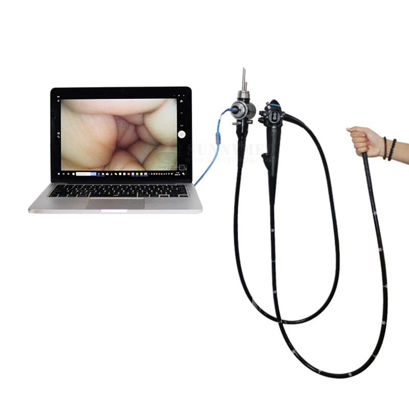 Sy-PC045 USB de Video Digital Sistema de endoscopia colonoscopio con funciones de fuente de luz LED