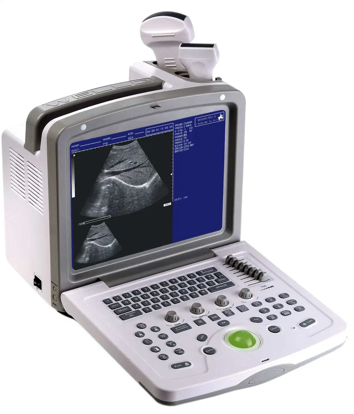 Full Digital Portable B/W Ultrasound Scanner for Veterinary Use