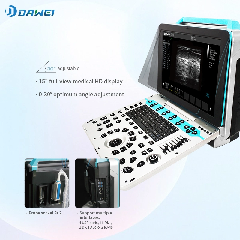 Hot Sales Ultrasound Scanner Equipment for Clinic with CE&ISO