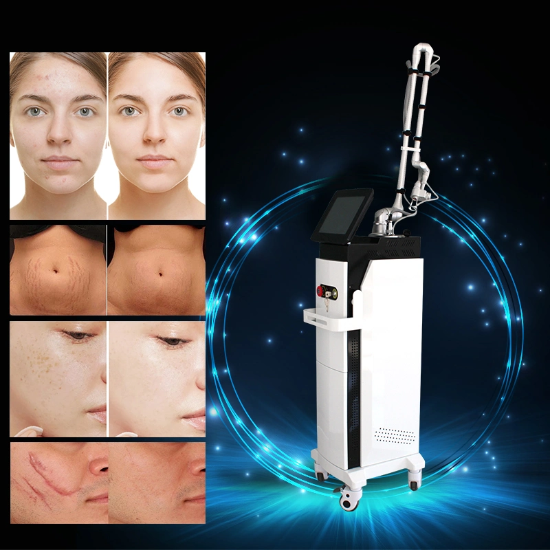 Entfernung von Dehnungsstreifen Vaginalstraffung CO2 Diodenlaser Fraktioneller Laser Skin Resurfacing Beauty Salon Ausrüstung