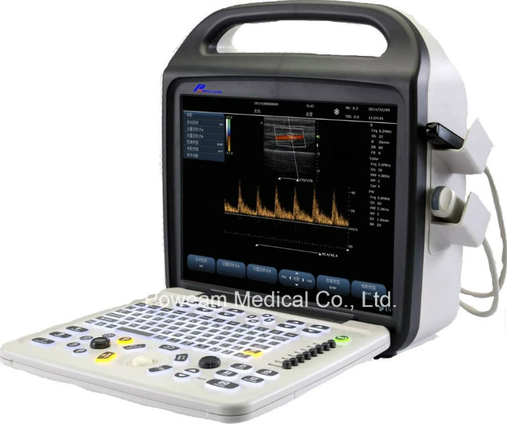 Ce Approved Hospital 4D Portable Color Doppler Ultrasound (C10)