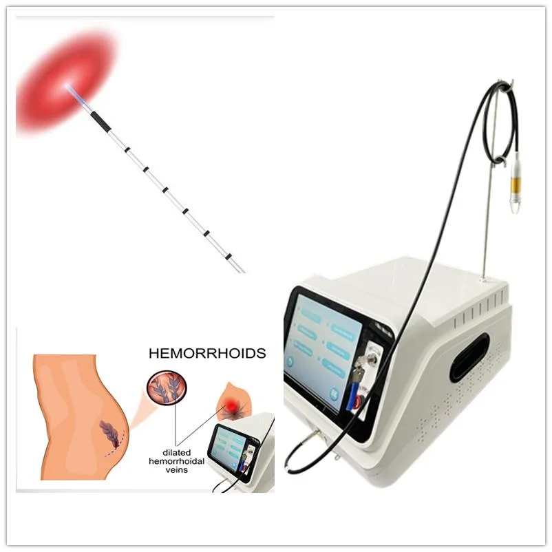 Minimally Invasive Laser 1470 Treatment of Piles/Fistula/Pilonidal Sinus Varicose Veins Hemorrhoids Removal Device