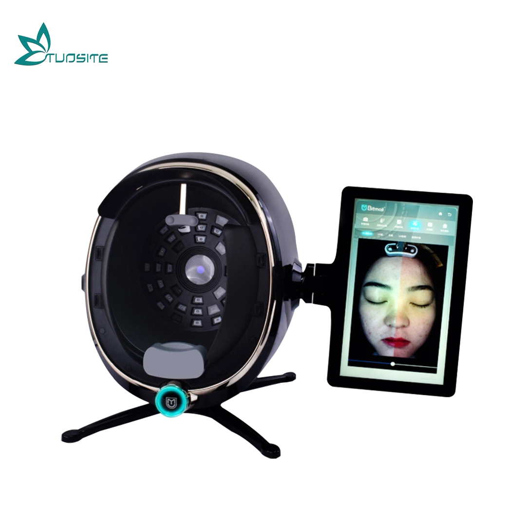 Skin Analysis Machine Skin Condition Analyzer Max Version Fast Identification of Skin Problem Report Support