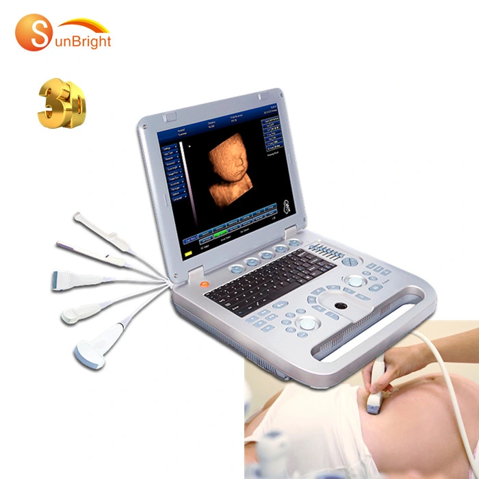 Portable Human 3D Ultrasound Scanner with Battery