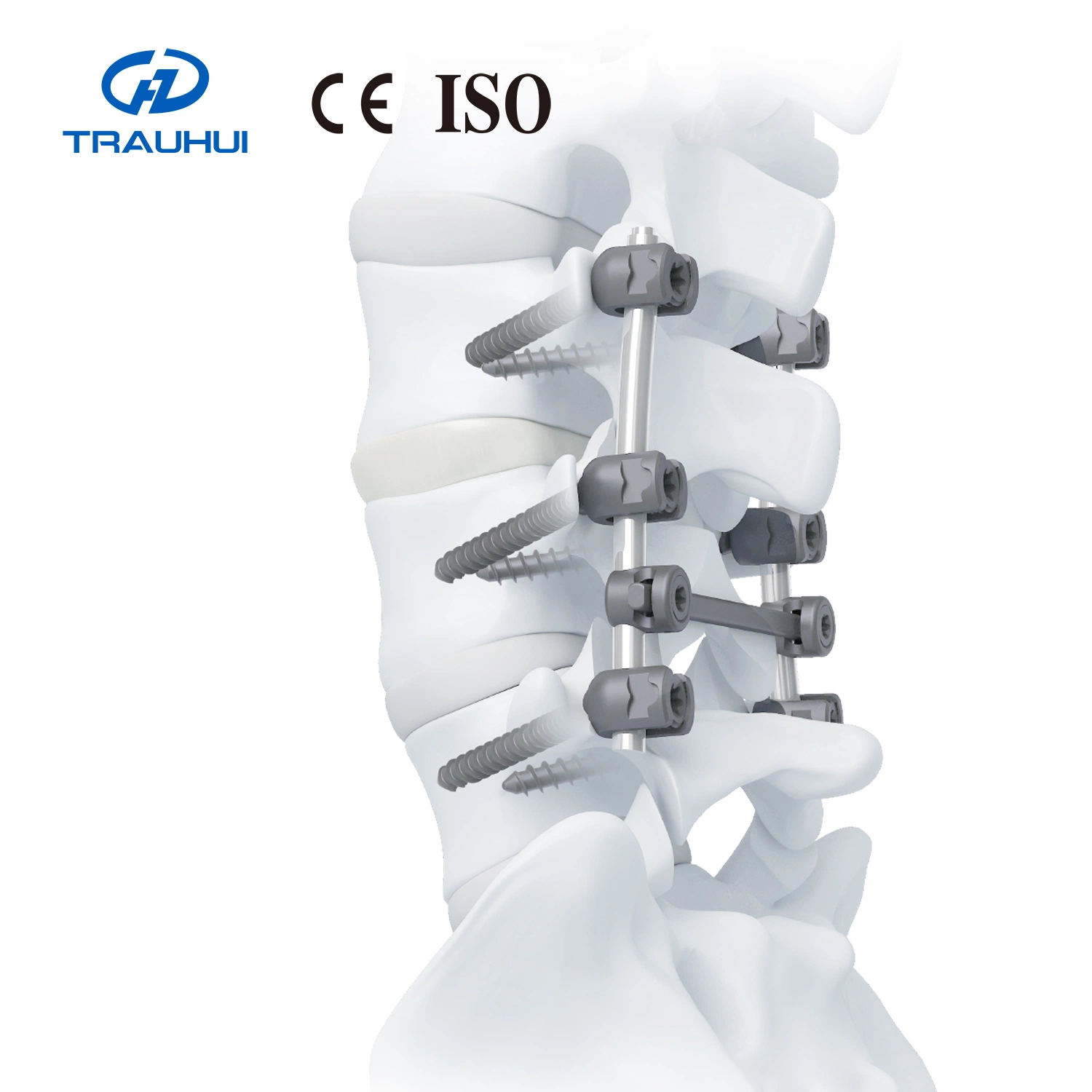 Conjunto de instrumentos de fijación cervical posterior