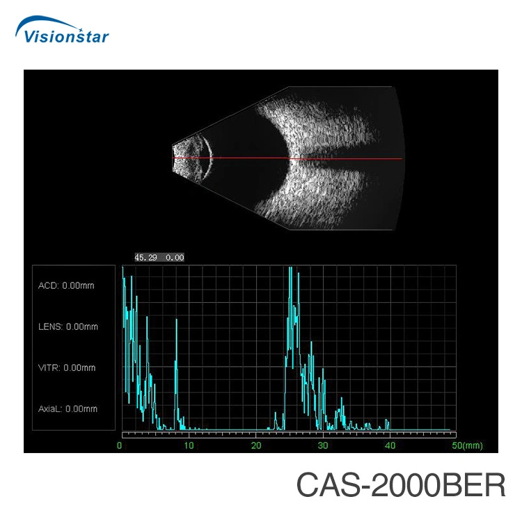 CE scanner à ultrasons ophtalmique approuvé, a/b, Ab de numérisation du scanner