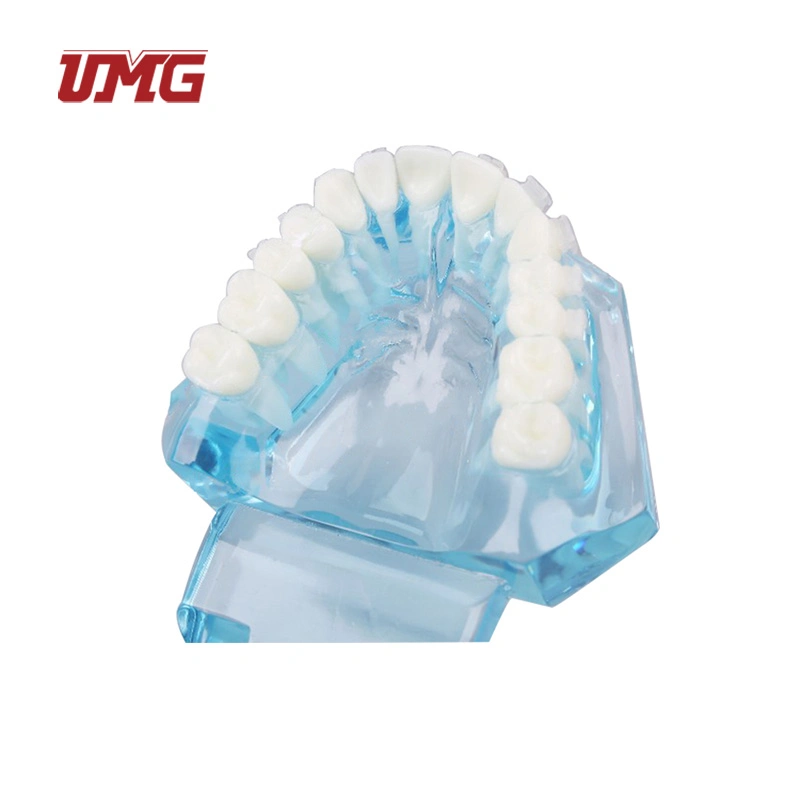 Transparent Dentition with Metal Brackets (3color) Dental Teaching Teeth Model