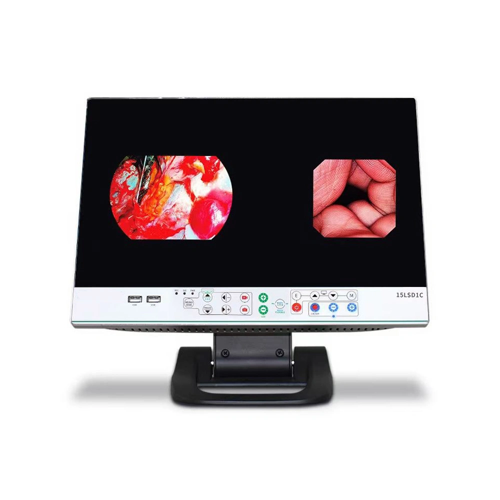 ICEN 1080p 15.6'' медицинская жесткая эндоскопическая камера Встроенный хирургический светодиод Монитор источника света