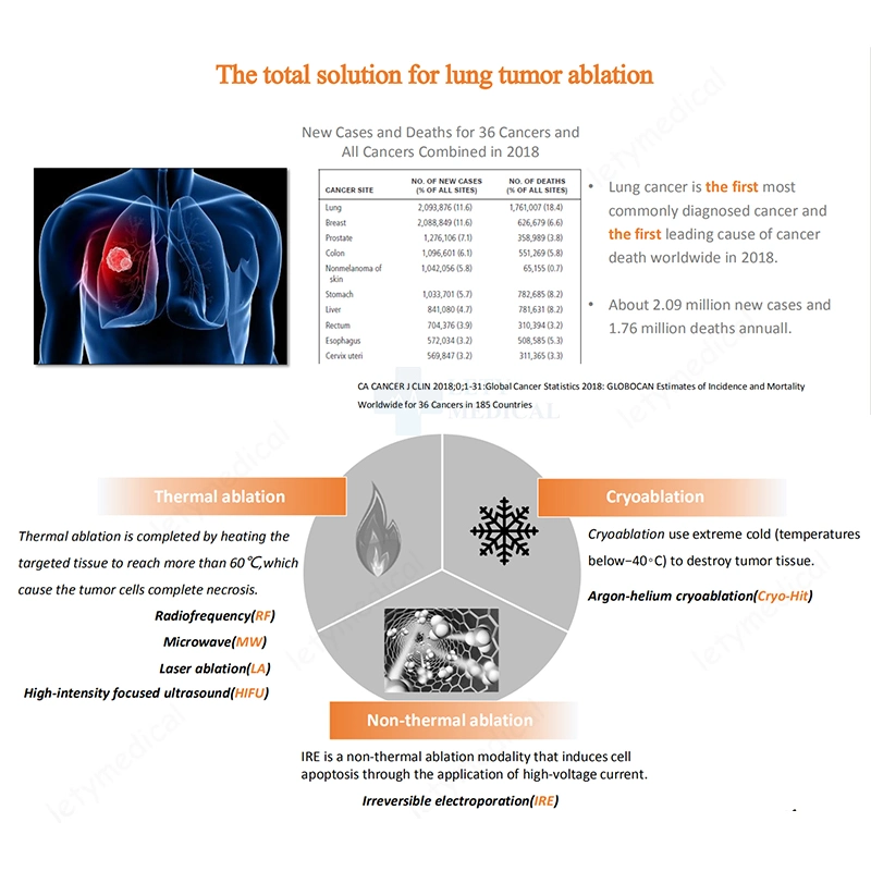 Neue Generation Ire Ablation System Elektroporation System Tumor Ablation Elektroporation Ire