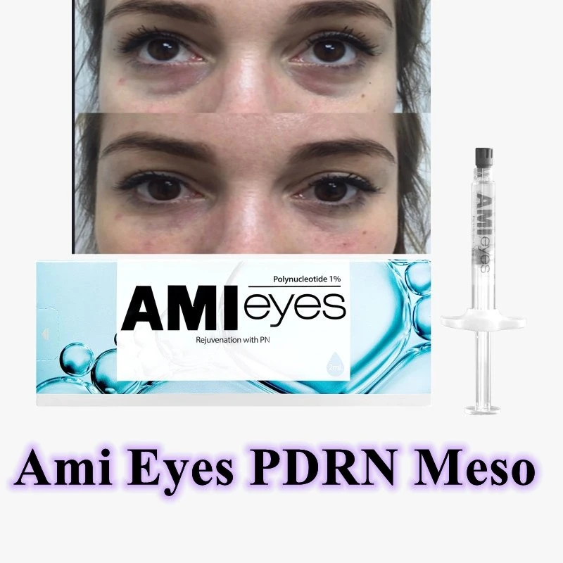 Wholesale Price Ami Eyes Removing Dark Circle Under Eye Wrinkles Treatment Eye Bag Lumi Eyes