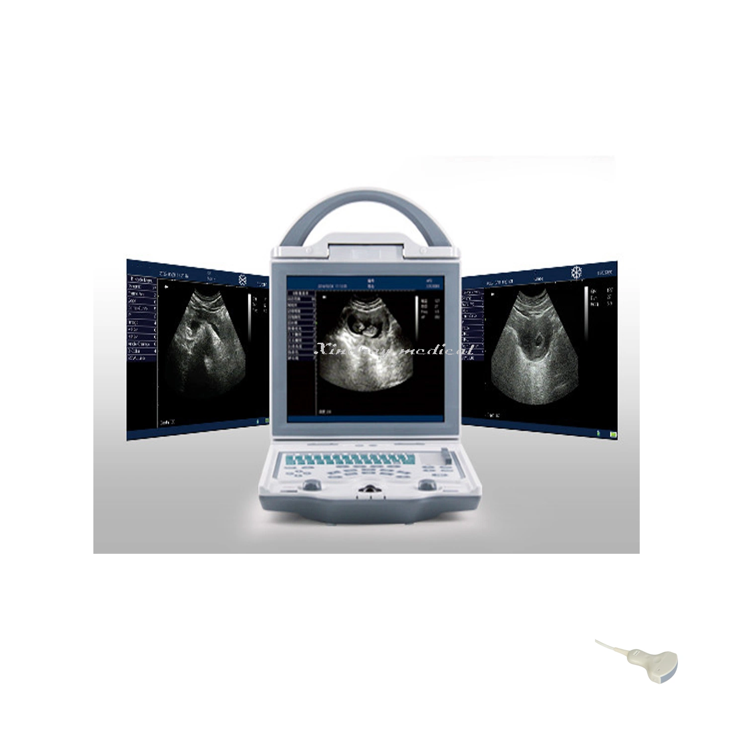 Portable Black and White Ultrasound Buy Ultrasound Scanner