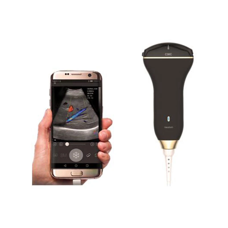 Lower Price USB Smartphone Echographe Portable Ultrasound Machine/Probe/Scanner