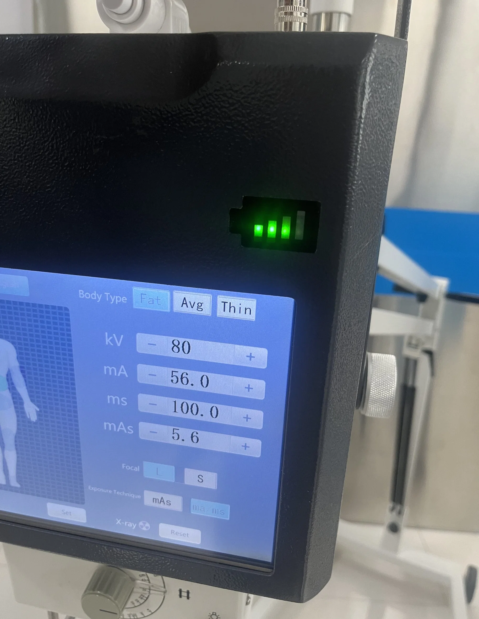 Revolucione la atención sanitaria con la máquina portátil de rayos X digital definitiva