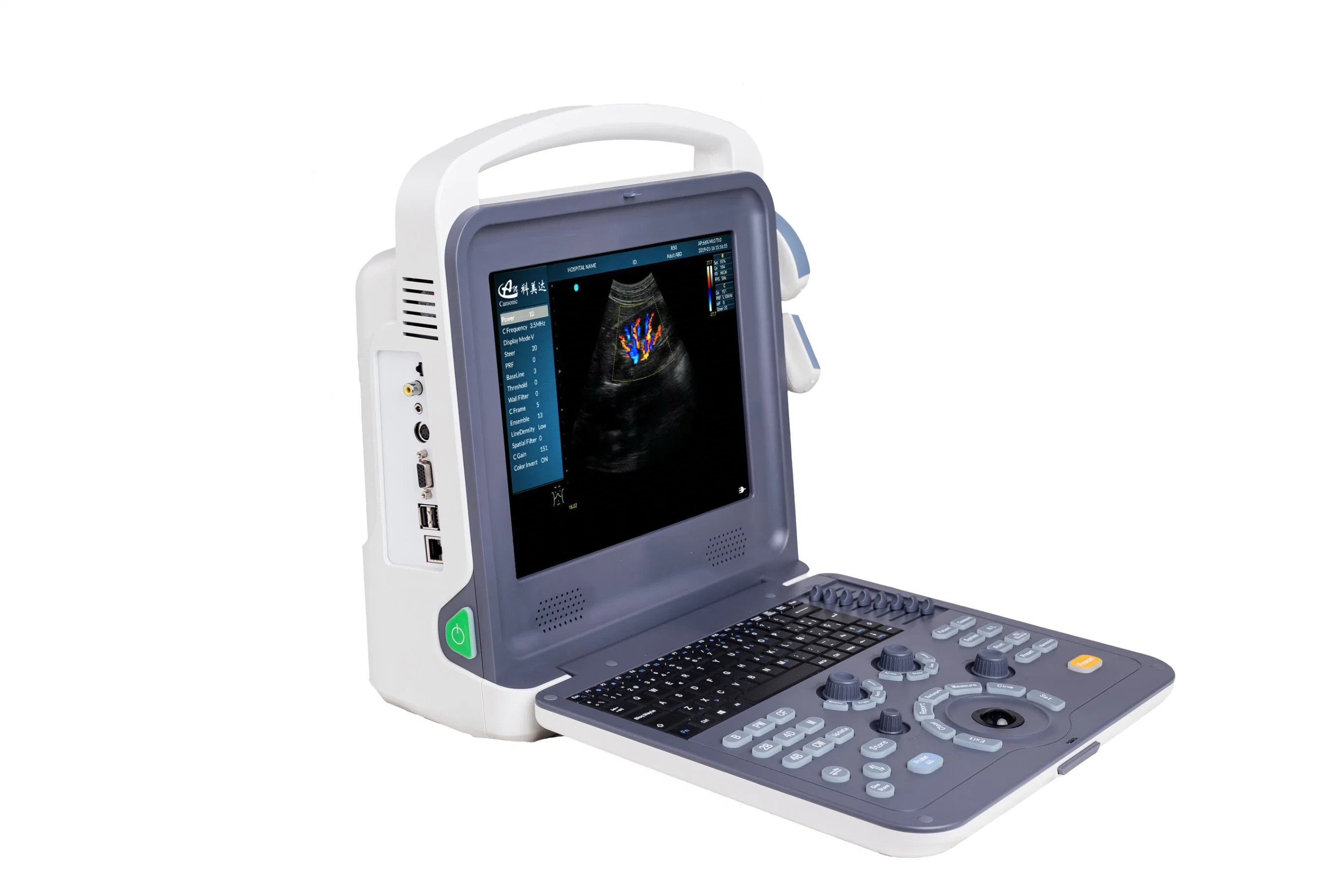 Portable Color Doppler Ultrasound Scanner for Female K0