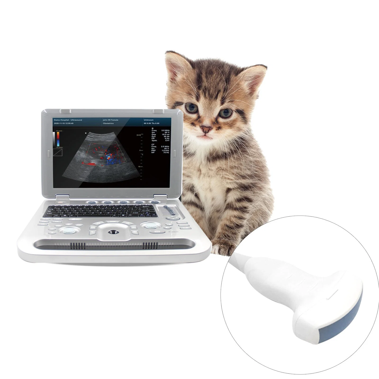 Contec Cms1700A Convex Array Extended Imaging Online Technical Support Ultrasound Machine