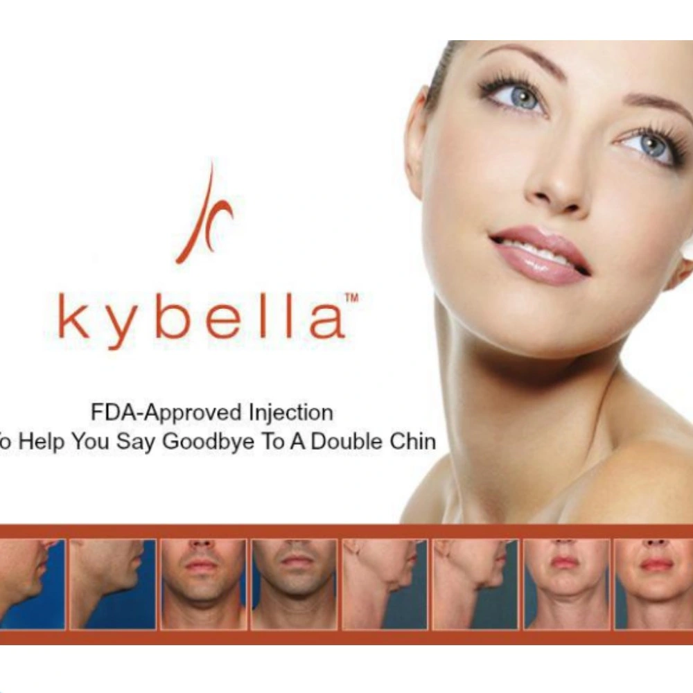 La perte de poids meilleure et la minceur naturel Belkyra facile Kybella double menton Kabelline injectable Fat dissoudre pour double menton produit la perte de poids