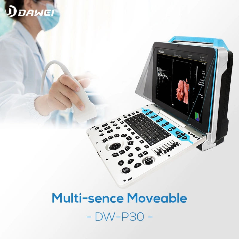 Dawei Dw-P30 Portable Abdominal Echography Doppler Color 3D 4D Ultrasound Echo Machine