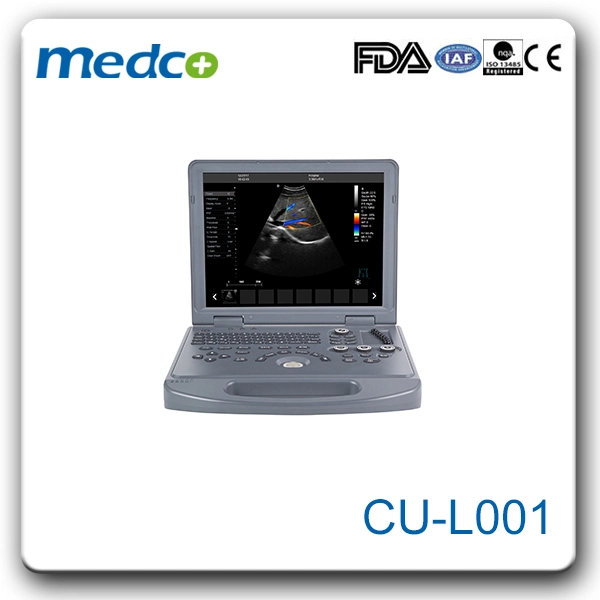 High quality/High cost performance  Portable Ultrasound Machine Digital Ultrasound Scanner