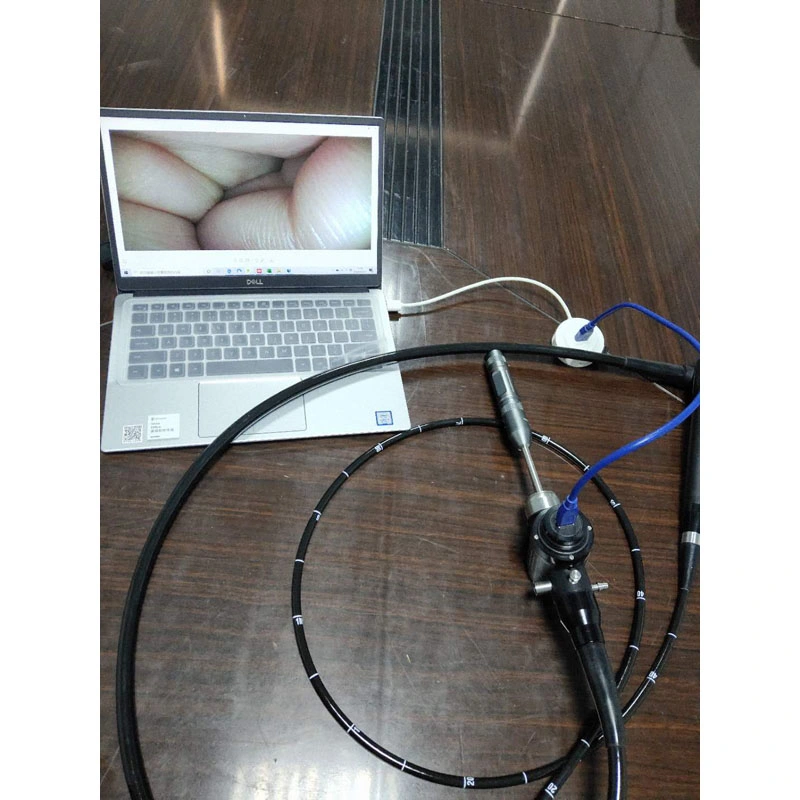 Vet Cheap USB Option Veterinary Gastro-Colonoscope System Price Flexible Video Gastroscope Colonoscope