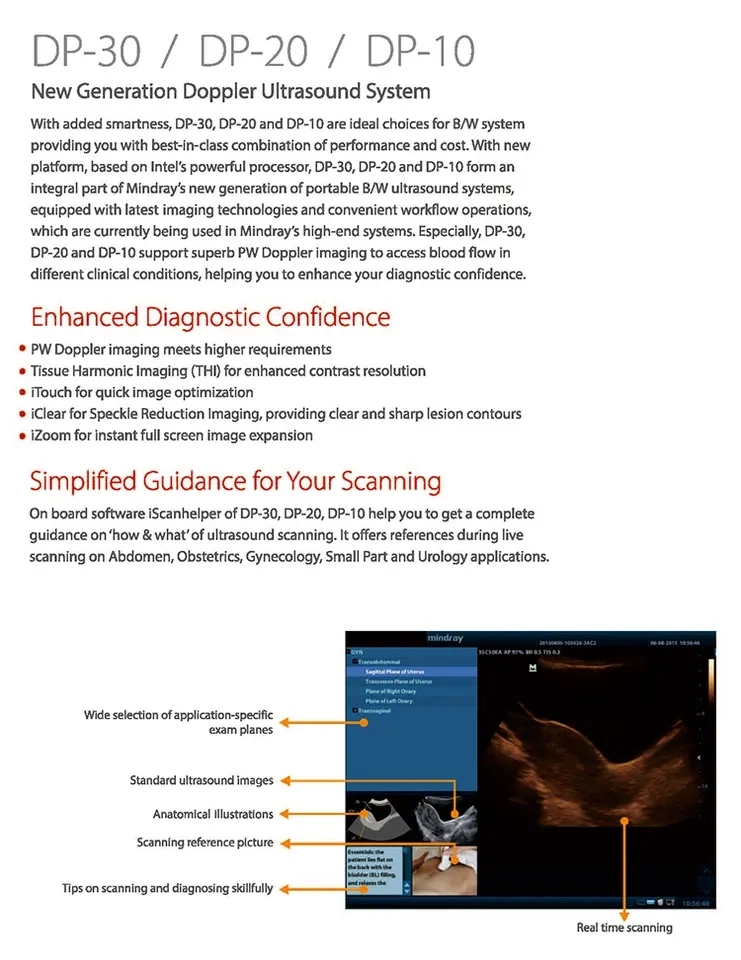 Mindray DP-30 4D Ultrasound portátil Doppler escáner de ultrasonidos