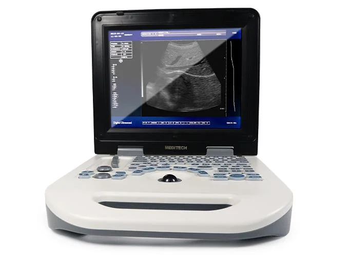 Dolphi-S New Full Digital B/W Ultrasound Scanner