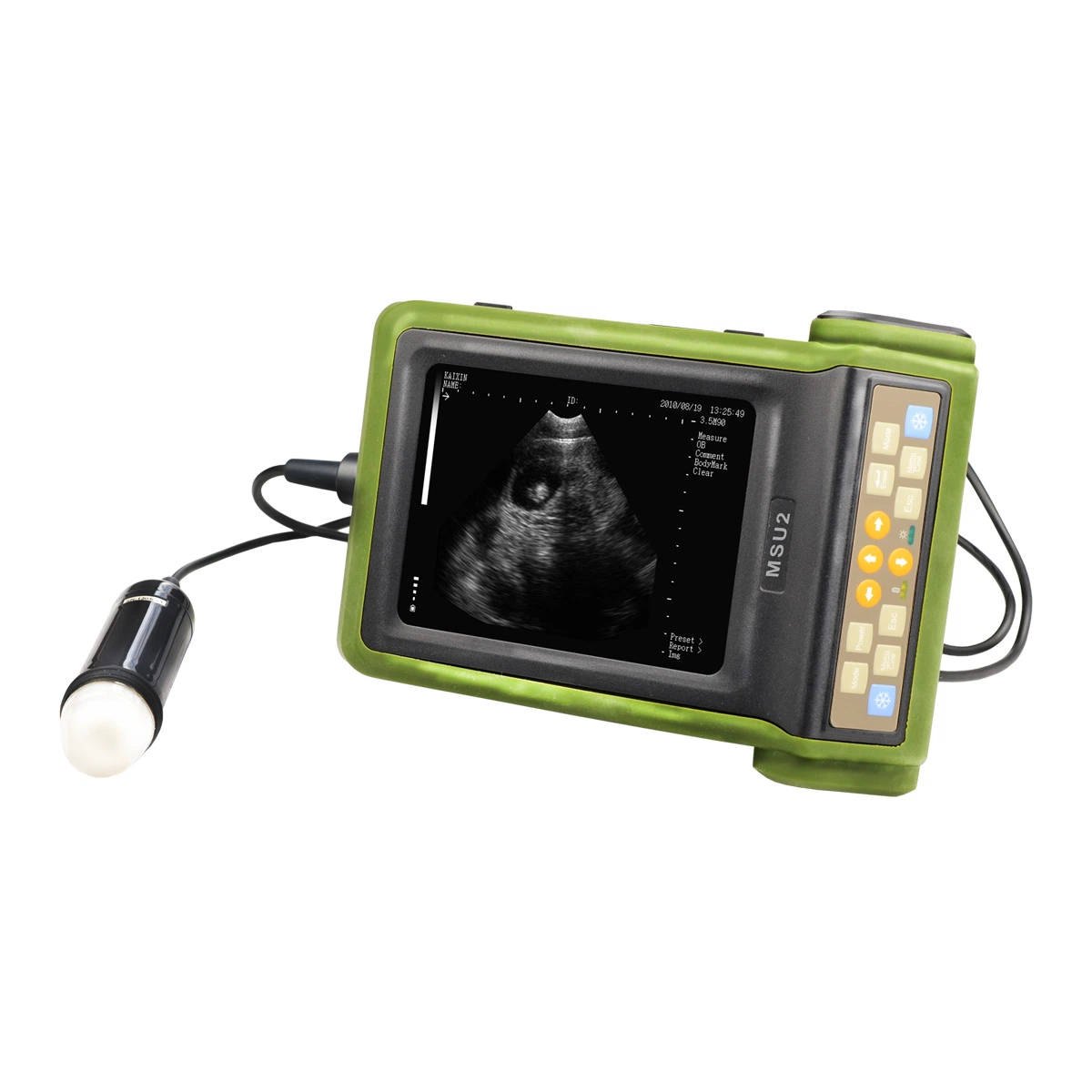 Vet Digital B-Mode Ultrasound Scanner for Animal (MSU2)