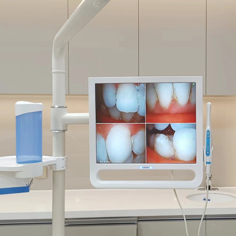 17 Inch Monitor and Intraoral Camera Unit for Dental Chair