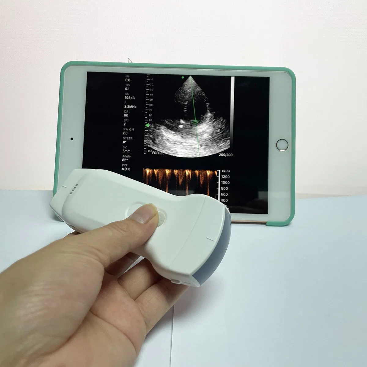 Wireless Android Ultrasound Probe WiFi USB Ultrasound Convex Linear Phased Array Doppler Probe for Pregnancy Price