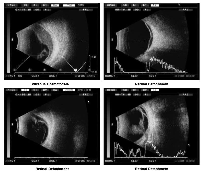 El uso de animales veterinaria Exploración B Ultrasonidos de alta calidad a/b Análisis de la oftalmología con gran pantalla (ODM-2200)