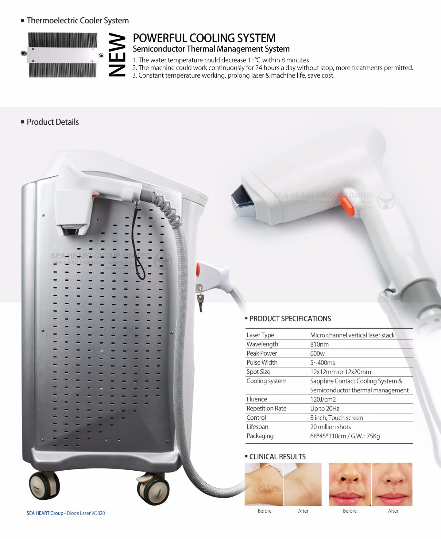 New Technology Diode Laser Beauty Machine for Hair Removal