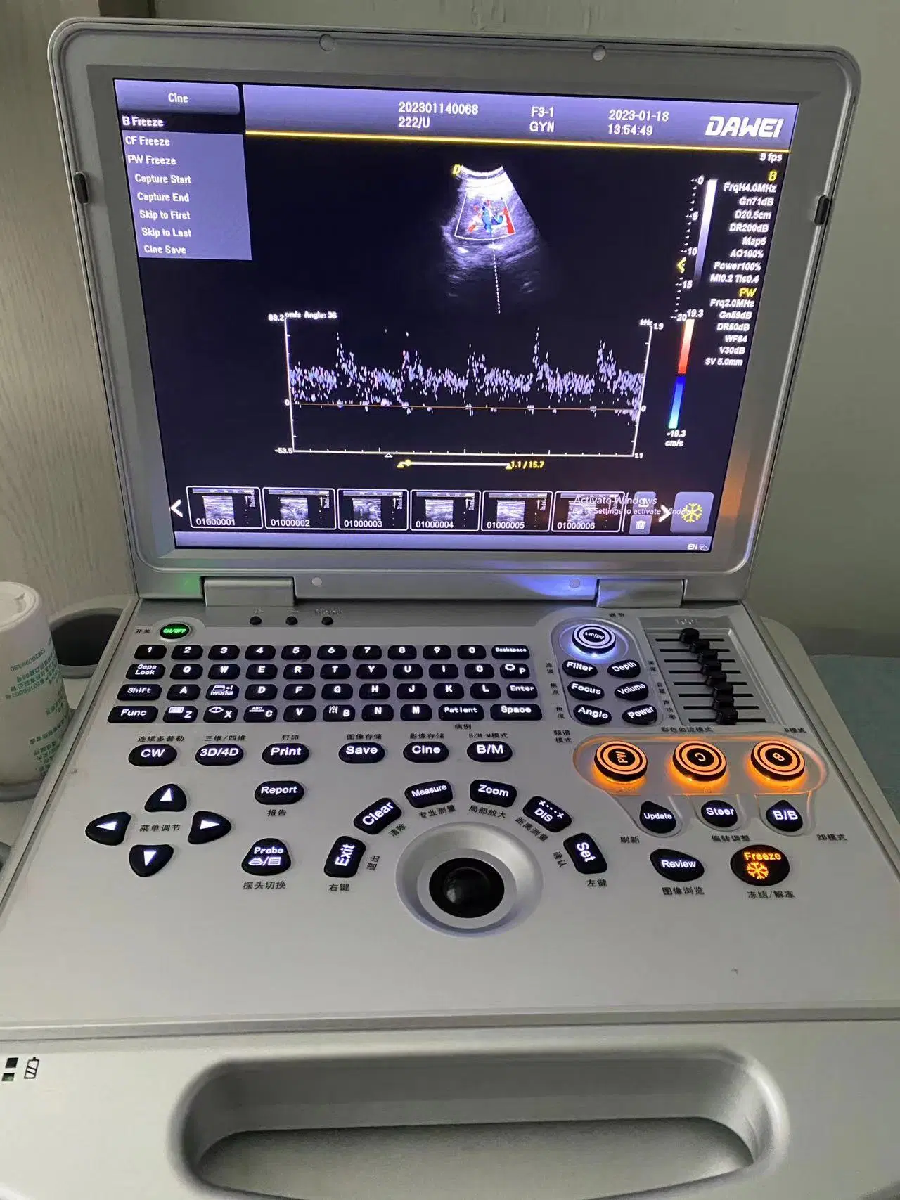 Dawei CE Certified Hospital Notebook Ultrasound Machine Dw-L3