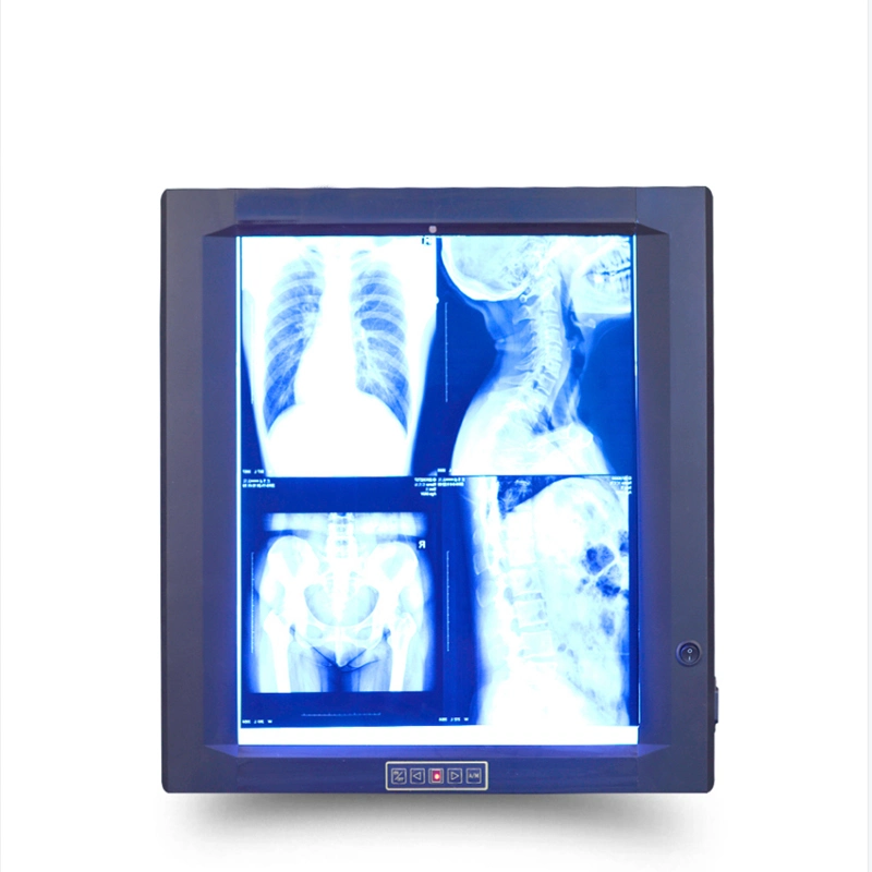 Hospital Negatoscope Xray Dental X-ray Film Viewer