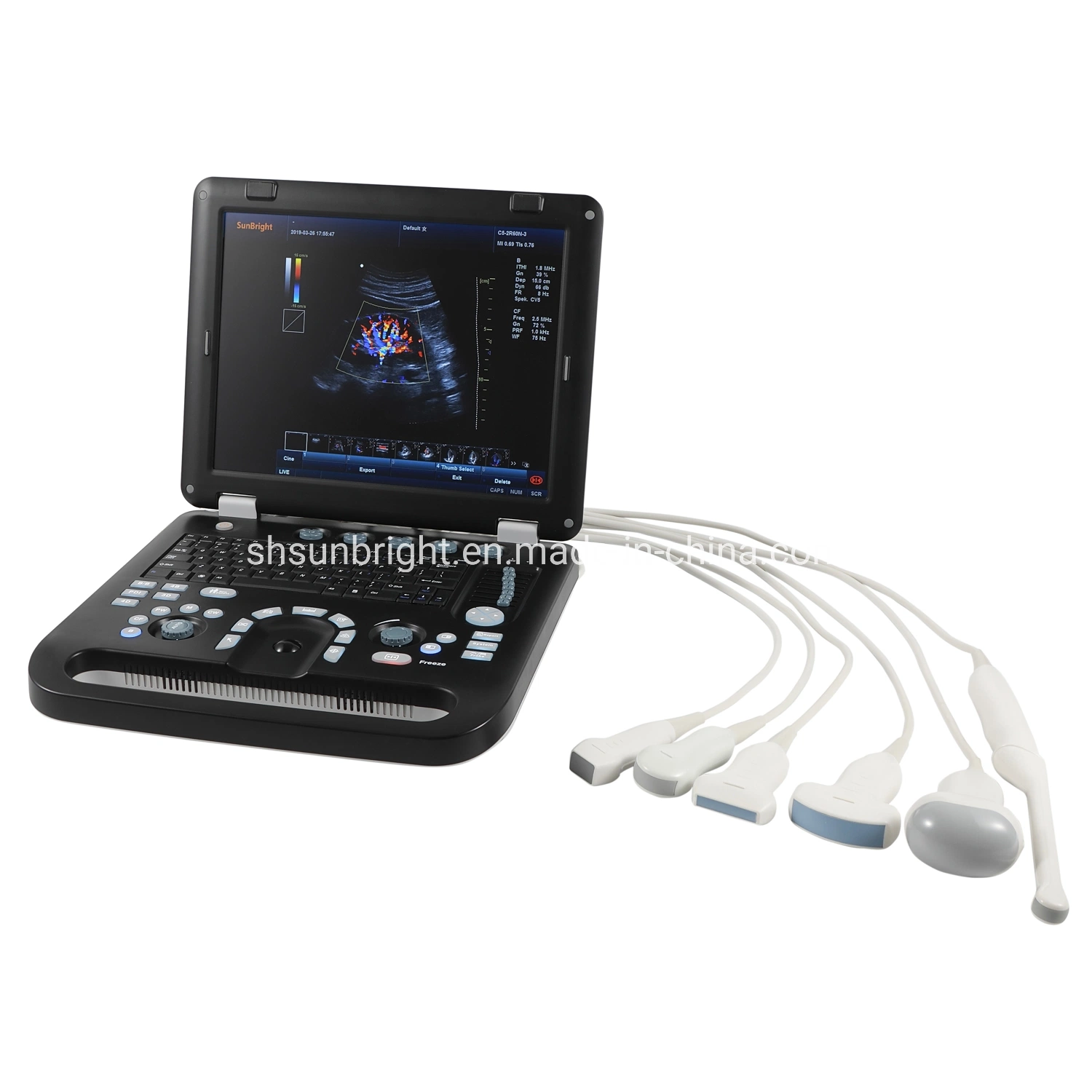 Ce Approved Portable Ultrasound Color Doppler Ultrasound Price Sun-906c 196 Elements