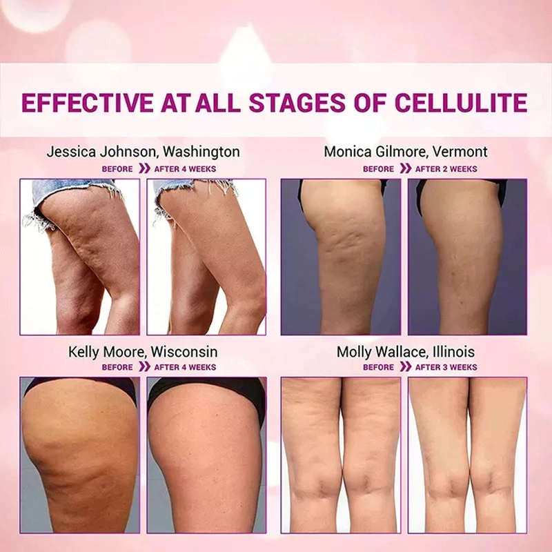 La pérdida de peso rápido de etiqueta privada de la Grasa de cintura Body Shaping Gel anti celulitis compacta caliente quema Barriga adelgazar crema caliente