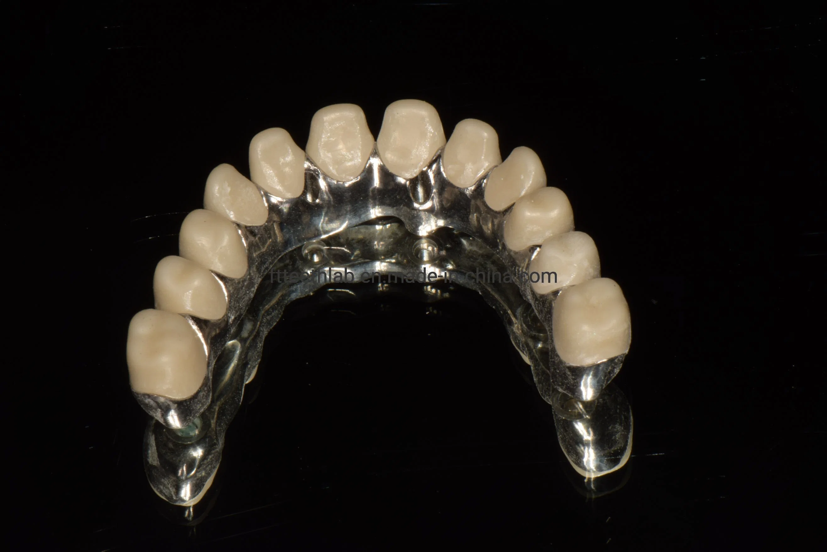 El arco completo de implantes dentales fijas puente para la rehabilitación de la boca