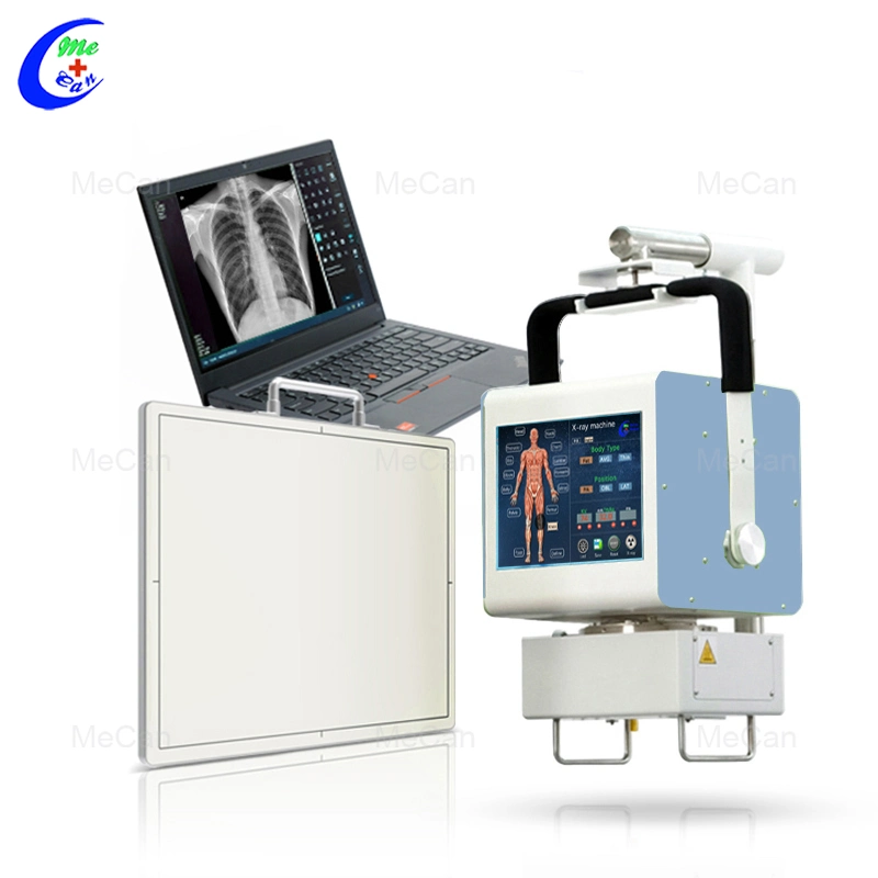 Radiography Chest Machine Other Radiology Equipment Radiographe Ray X Portable with Cheap Price