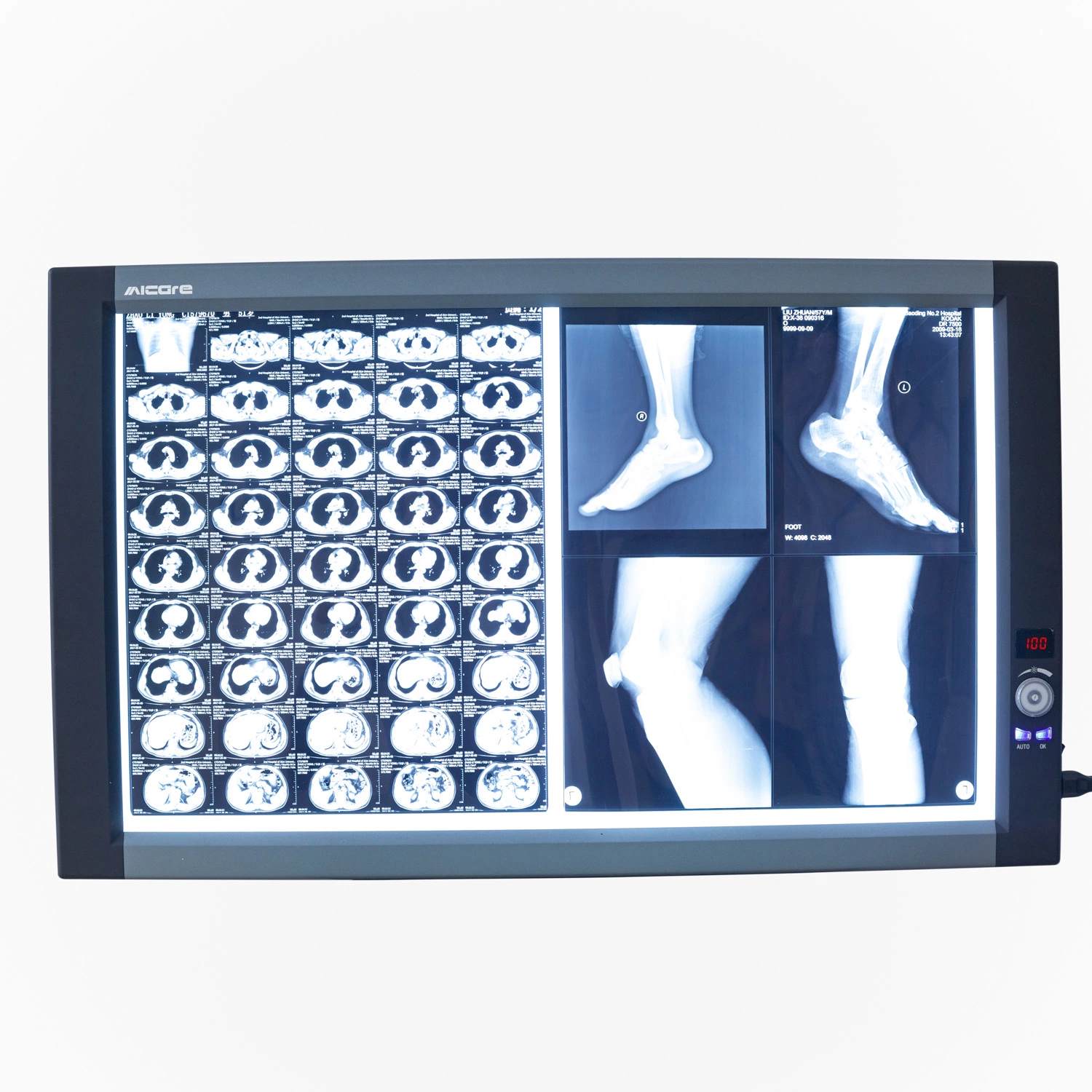 LED X Ray Viewer, Negatoscope, Medical Film Viewer Double Screen Zg-2c