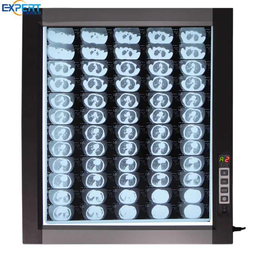 Professional Medical LED Film Viewer X-ray View Box