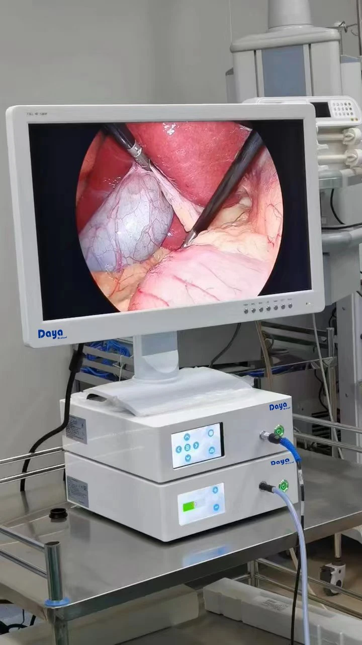 Surgical Medical Endoscopic Camera for Laparoscopic Surgery