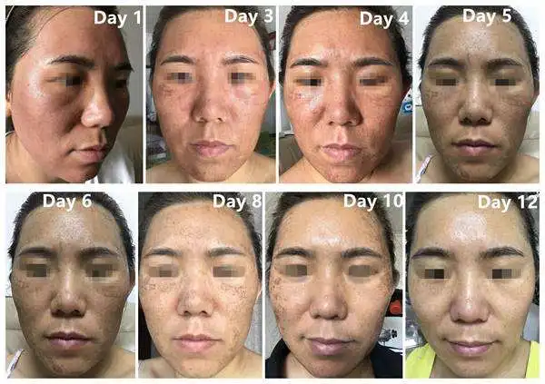 Beauty Multifunction Ultrasonic Device Facial Steamer Skin Scrubber Beauty Salon Equipment