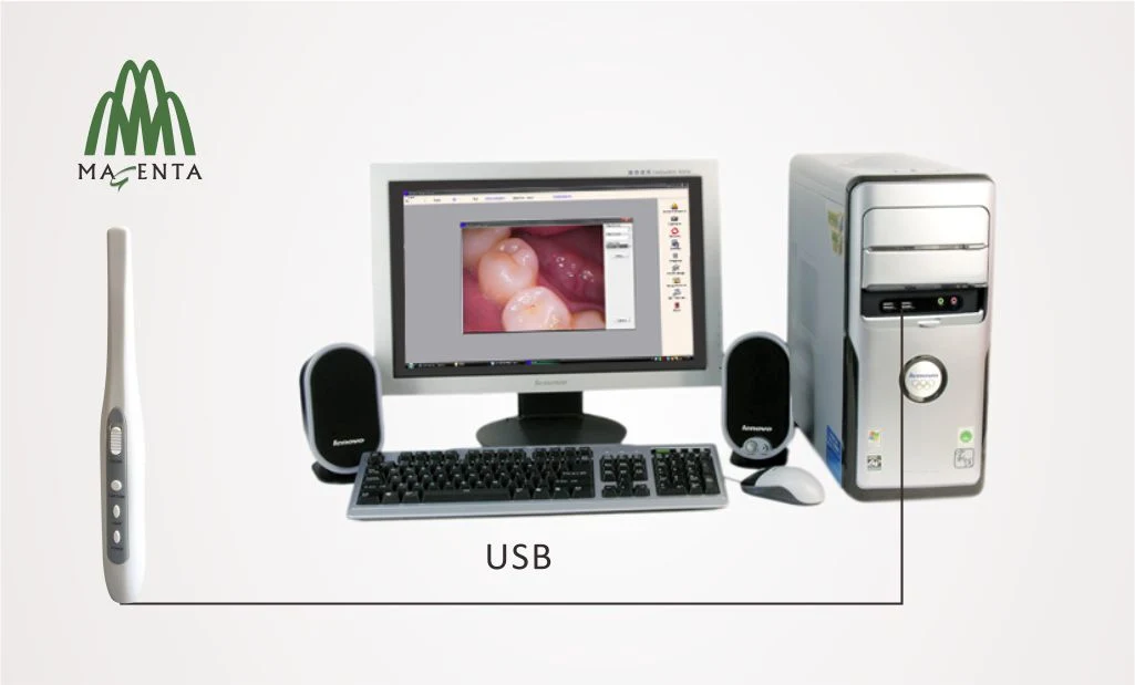 كاميرا USB ذات تركيز بؤري داخلي MD830UF من سوني CCD 2.0 ميجا بكسل