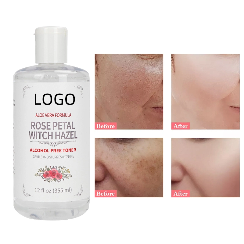 Hautpflege Whitening reines und natürliches feuchtigkeitsspendend Gesichtsbblütenwasser Rose Toner