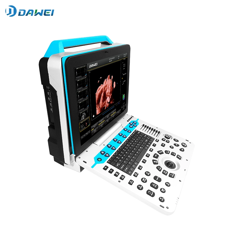 Two-Probe Interface Portable Design Full Digital Ultrasound Scanner 3D4d5d