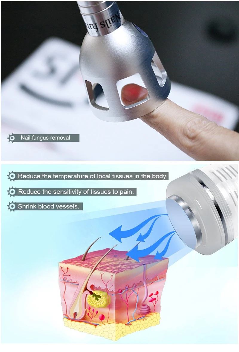 40W 3 in 1 Blood Vessel Removal Laser 980nm Diode Laser Vascular Cleaner Spider Veins Removal for Beauty Salon Use