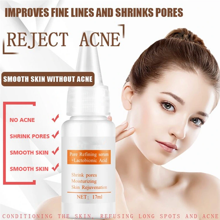 Custom Niacinamide Acid Serum Acne Scar Removal Whitening Peeling Solution