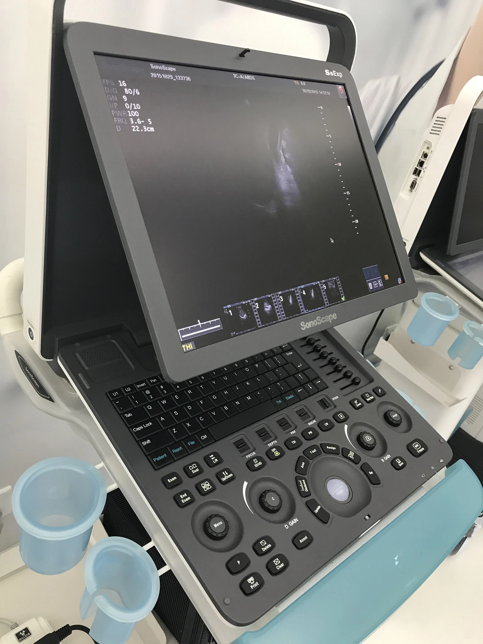 Sonoscape S8expv escáner de ultrasonidos veterinarios