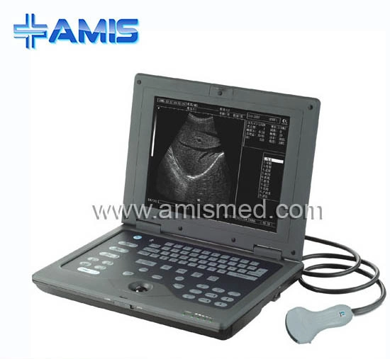 Digital Notebook Ultrasound Scanner (AM-2018)